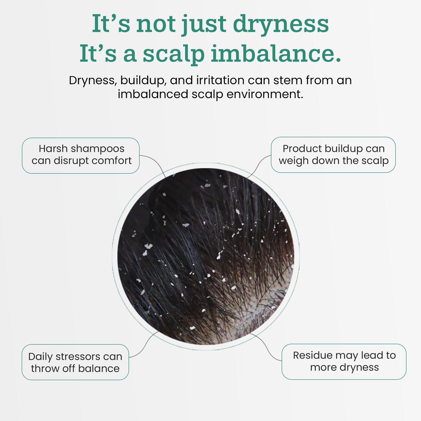 ScalpRx Scalp Recovery Oil – Dandruff & Itch Relief