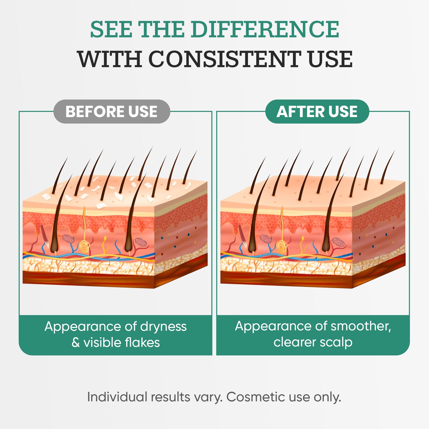 ScalpRx Scalp Recovery Oil – Dandruff & Itch Relief