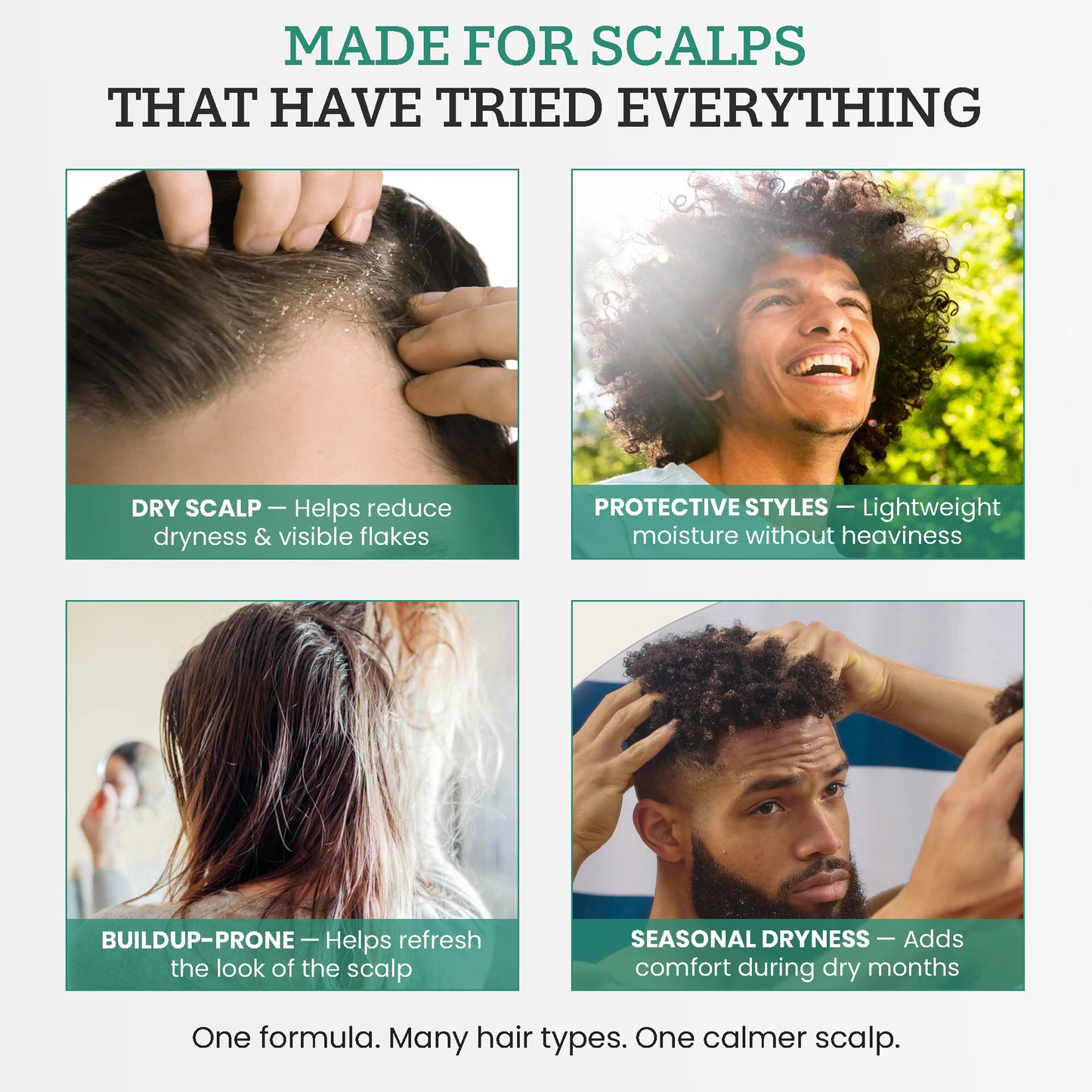ScalpRx Scalp Recovery Oil – Dandruff & Itch Relief