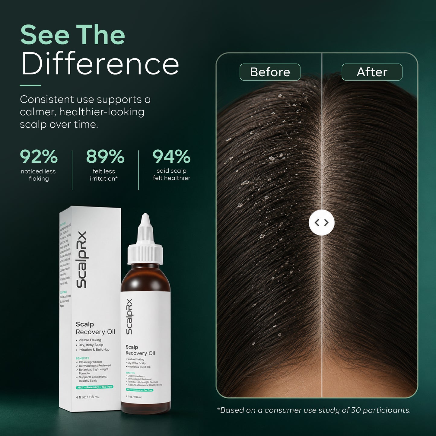 ScalpRx Scalp Recovery Oil – Dandruff & Itch Relief