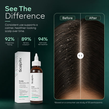 ScalpRx Scalp Recovery Oil – Dandruff & Itch Relief