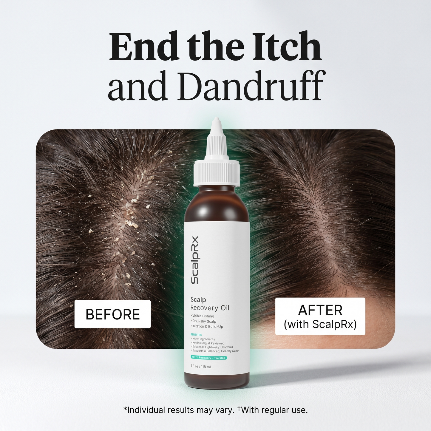 ScalpRx Scalp Recovery Oil – Dandruff & Itch Relief
