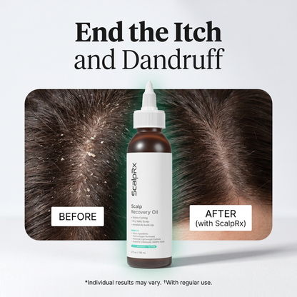 ScalpRx Scalp Recovery Oil – Dandruff & Itch Relief
